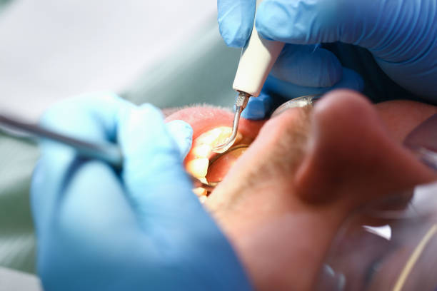 Best Emergency Treatment for Dental Infections or Abscesses in Signal Mountain, TN
