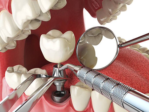 Best Cosmetic Emergency Dentistry in Signal Mountain, TN